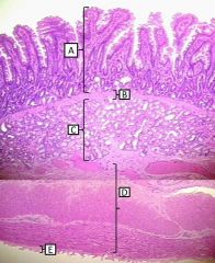 Histological layers of the duodenum