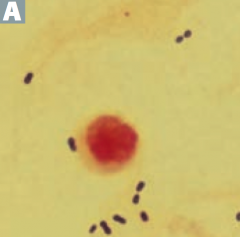 Catalase (-), α-hemolysis (partial)
- Lancet-shaped
- G+ diplococci
- Encapsulated (no virulence w/o capsule)
- IgA protease
- Optochin sensitive = OVRPS)