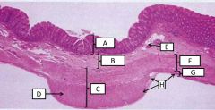 Histological features of the colon
