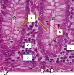 Base of mucosal gland in large intestine