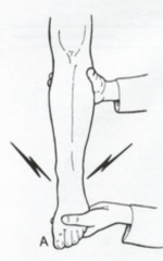 - Examiner compresses tibia / fibula at midcalf


- Tests the Syndesmosis


- Pain at anterior ankle joint (below where examiner is squeezing) suggests syndesmotic ("high ankle") injury