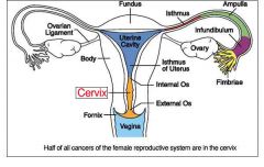 Ampulla of uterine cavity (right beneath infundibulum)