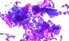 Name one thing seen in this ear cytology