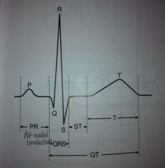 PR interval includes conduction delay through atrial muscle and the AV node. Most of this interval is the result of slow conduction through the AV node.