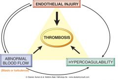 Virchow's triad

(1) Disruption in blood flow
(2) Endothelial cell damage
(3) Hypercoagulable state