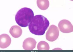 Is this a lymphoblast or myeloblast? How can we tell?