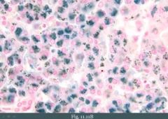 (1) Brown pigment in hepatocytes

We distinguish it from lipofuscin by staining with Prussian blue which stains iron blue.