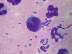 Name two things seen in this ear cytology