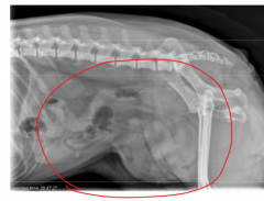 what abnormality is this abdominal x-ray indicative of?