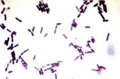 Name this type of bacteria that may be seen in an ear cytology