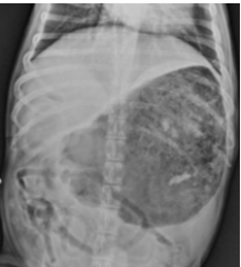 this x-ray is most consistent with:
a) gastric dilation
b) gastric torsion
c) volvulus
d) abdominal mass