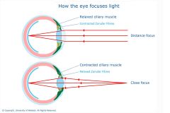 The shape of the lens is controlled by the ciliary muscles which contract/relax the zonular fibres.


Ciliary contraction = zonular relaxation
Ciliary relaxation = zonular contraction