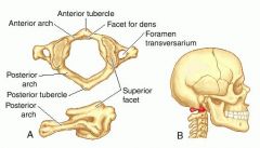 i.	Lacks a body and a spinous process
ii.	Contains an anterior arch and anterior tubercle, a posterior arch and posterior tubercle, and a lateral mass