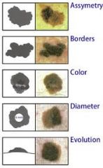 assym - 1/2s don't match
ragged border
color varies
diameter larger than eraser
evolve bigger