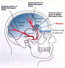 the branches of the middle meningeal artery lies in grooves of bones between the skull and the dura mater (unlike the venous sinuses which lie between the layers of the dura mater)