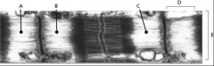  




17-57 Figure Q17-57shows an electron micrograph of a skeletal muscle fiber, where various points along a fiber and various regions have been labeled.


 