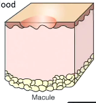 This is a macule/patch

Flat/flush with surface, color of the skin, most common changes due to blood or melanin
Macule <1cm
Patch >1cm