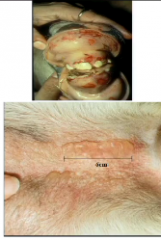 What are these lesions?
