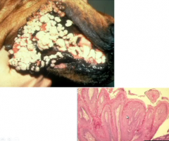 What are these lesions called?