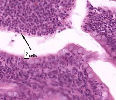 Ileum


identify cell - location - characterize