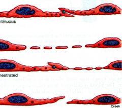 types of capillaries

top to bottom