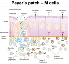 Aggregated dense lymphatic tissue can be found in the Peyer's patch (lines the gut, found in ileum)
-lymphatic tissue is partially encapsulated



Peyer's patch has M cells transcytose antigens from the lumen to the submucosal side to the lymphati...