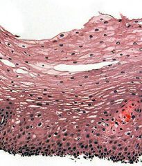 A- Stratified squamous epithelial tissue

The area on the bottom of the image is called the germinal layer. Cells here do perform division.