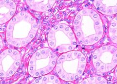 `Which type of epithelial tissue is this?
A- stratified squamous
B- stratified columnar
C- simple squamous
D- simple cuboidal