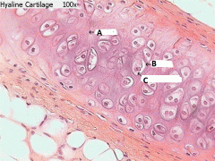 Here is an image of cartilage tissue.
Cells found within the tissue are called -chondrocytes, the substance (matrix) in which they are suspended is known as -chondrium, and each cell has its own encasing known as a -lacuna.
Attribute these terms...