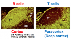 B cells go to outer cortex of nodules


T cells go to the inner/deep (paracortex)


T cells are not nodular