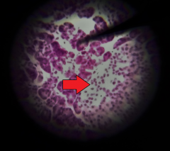 Do the cells of the structure at the tip of the red arrow have an endocrine or exocine function?