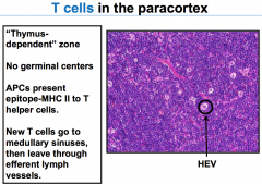 T cells in paracortex:


Haveno germinal centers, no nodules, no B cells 
HasHEV, T cells, and APCs (not B cells),macrophages