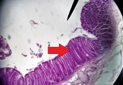 Identify the cells at the tip of the red arrow
