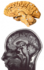 Identify structures in the brain (Saggital) 