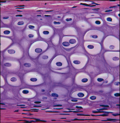 The small cavity that chondrocytes occupy. These are surrounded by a pericellular capsule