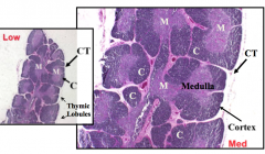 Thymus:lymph epithelial organ and site of T cell differentiation and proliferation


Thymus has 2 large lobes, each consists of lobules containing cortex and medulla and are partitioned by CT trabeculae
-also have lymphatic vessels and blood vesse...