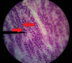 What specific cells are at the tips of the red arrows (left of pointer)?