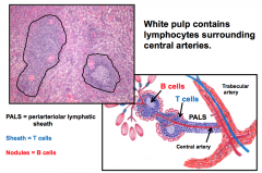 White blood cells = lymphocytes = White pulp