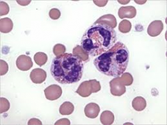 Feline Blood: What breed-specific Morphologic Abnormality is this?