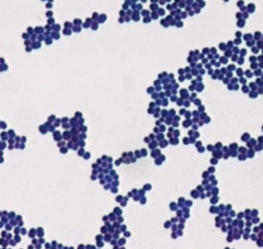 List one possible bacteria that this microscope image shows: