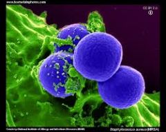 Methicillin resistant staphylococcus aureus 