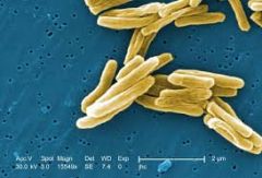 Mycobacterium 