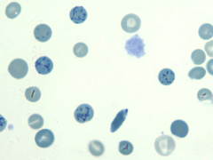 - Normally 1% of peripheral erythrocytes
- Detected using RNA stains