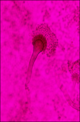 Aspergillus
Ascomycota
Asexual spores: Conidiospores
