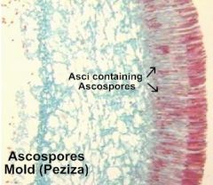 Peziza
Ascomycota
Sexual spores: Ascospores (saclike acus)