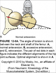 -head of the femur is rotated 15 degrees anterior relative to the condyle