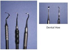 Periodontal scalers are used to remove calculus from teeth. Scalers are used above the gum line, and curettes are used below it. Use of a scaler below the gum line is likely to damage the gingiva (gums). Scalers are universal and have scraping ed...