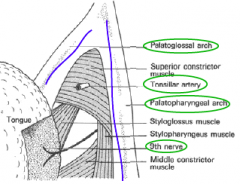 In the fossa between the palatopharyngeal and palatoglossal folds.

Bed of the tonsil contains the glossopharyngeal nerve and the tonsillar branch of the
facial artery.
