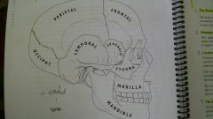 Parietal, Frontal, Occiput, Temporal, Sphenoid, Zygoma, Maxilla, Mandible.