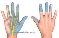 1. C5 - T1
2. Innervates muscles of anterior forearm + thumb
3. Innervates skin of palmar 3.5 digits + nail beds
4. Runs through the carpal tunnel so injury can lead to carpal tunnel syndrome
